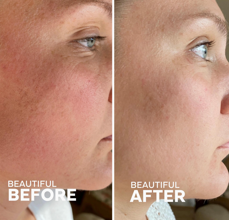 Three Ships Skin Hero Bakuchiol + Calendula Bio-Retinol Serum (30mL)